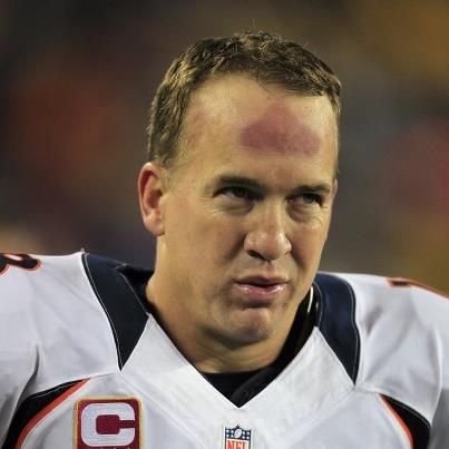 Peyton Manning Red Forehead
